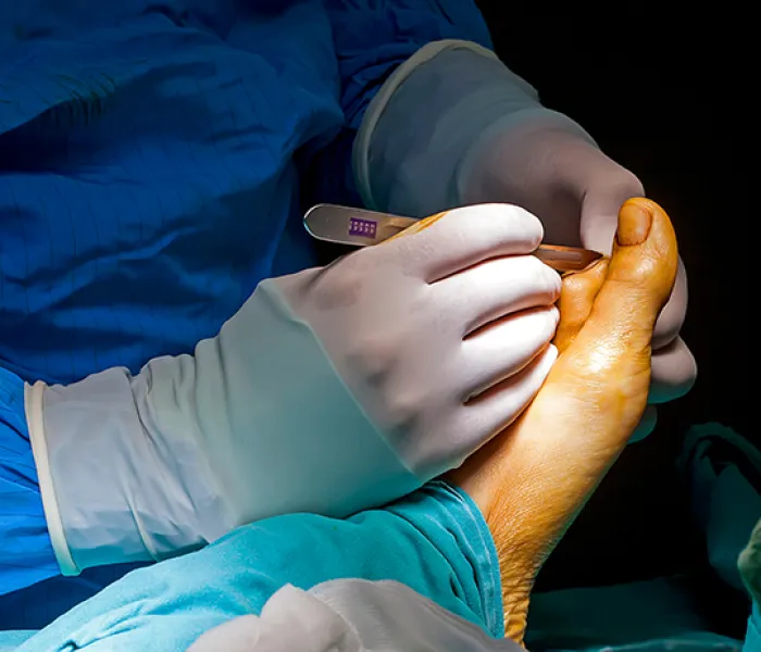 Programa de desarrollo profesional permanente en cirugía de pie y tobillo
